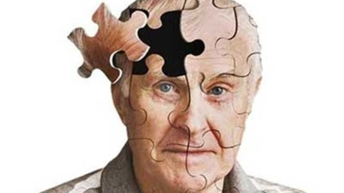 آلزایمر