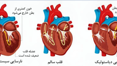 مهم ترین دلیل افزایش نارسایی قلبی چیست؟