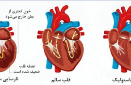 مهم ترین دلیل افزایش نارسایی قلبی چیست؟