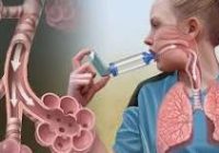 یک مطالعه جدید درباره علت آسم و آلرژی‌های فصلی